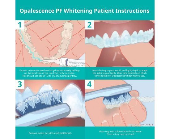 Гель для відбілювання зубів Opalescence 10% Ultradent шприц 1.2мл 3010-2746 фото