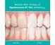 Гель для відбілювання зубів Opalescence 10% Ultradent шприц 1.2мл 3010-2746 фото 2